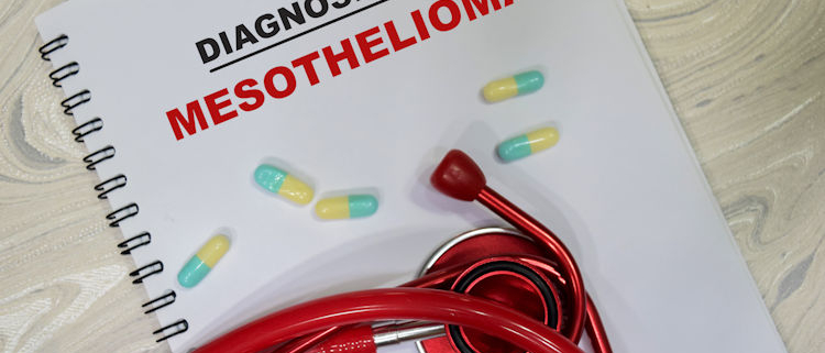 Mesothelioma
